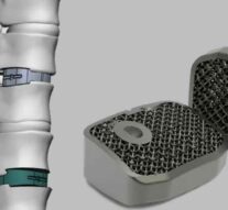 Первые 3D-позвонки из титана для парализованных  пациентов зарегистрировали в России